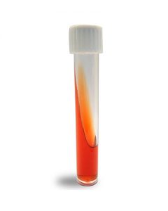 Môi Trường Kligler Iron Agar (KIA)